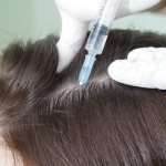 какие можно делать инъекции для роста волос