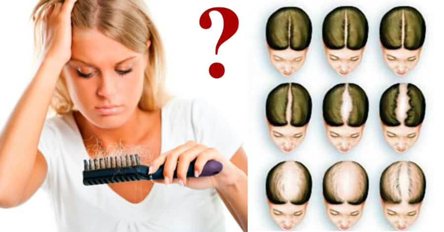 Тест на выпадение волос у женщин